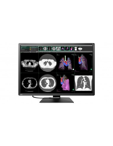 radiforce-monitor-309-color-4200-x-2800-12mp-1.jpg
