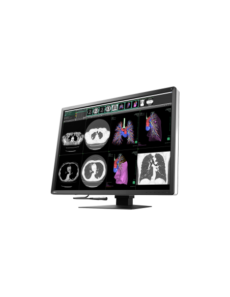 radiforce-monitor-309-color-4200-x-2800-12mp-4.jpg