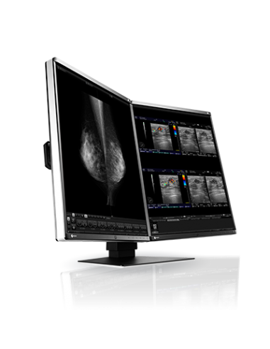 radiforce-medic-color-mammotomo-ref-3.jpg